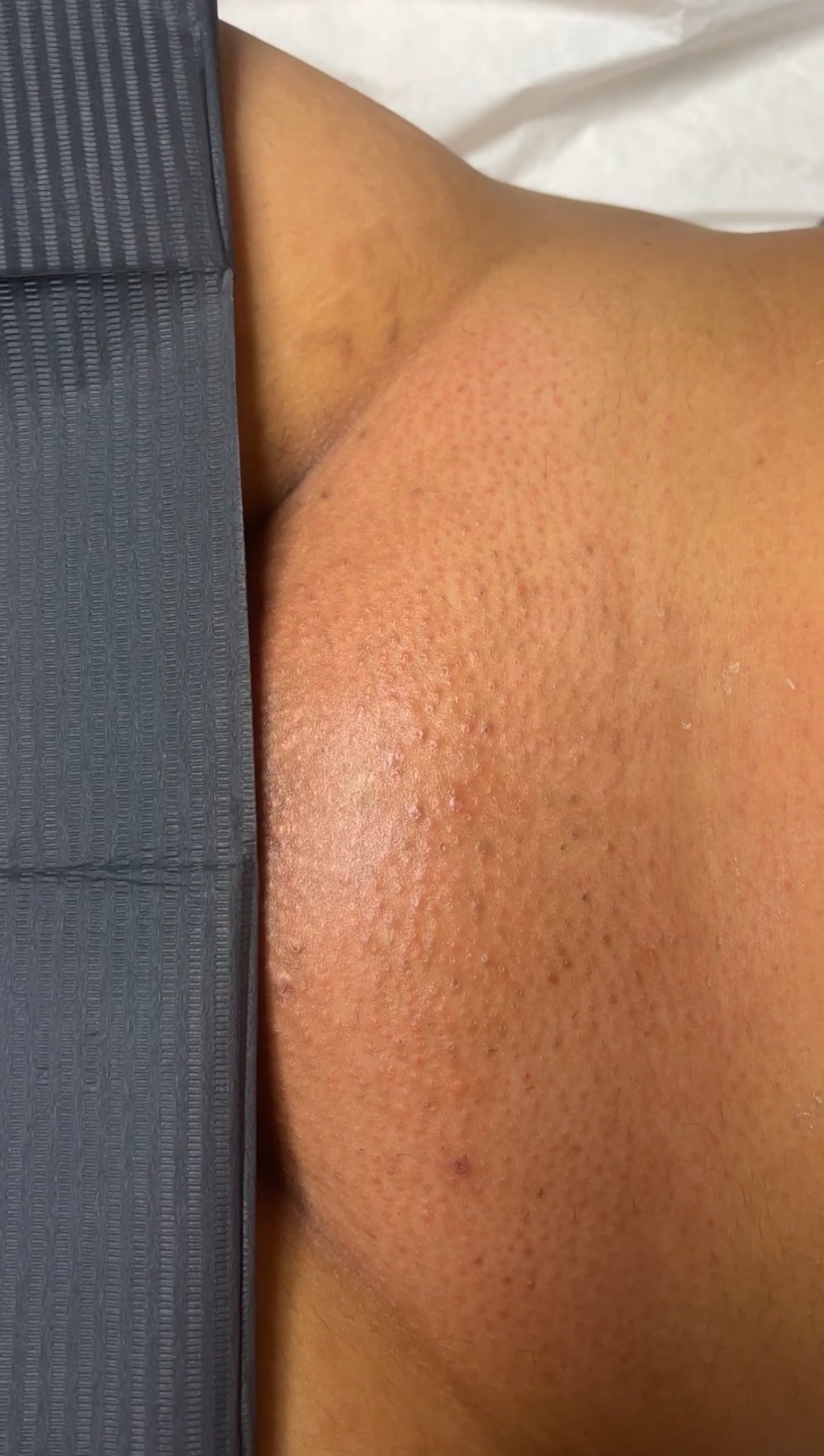 Smooth underarm skin after professional waxing at The Beautology Shop in Houston, TX